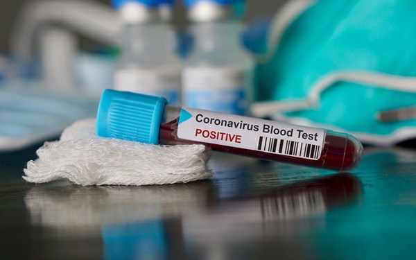 Coronavirus Case Count of Ghana Jumps To 4,700 With 494 Recoveries